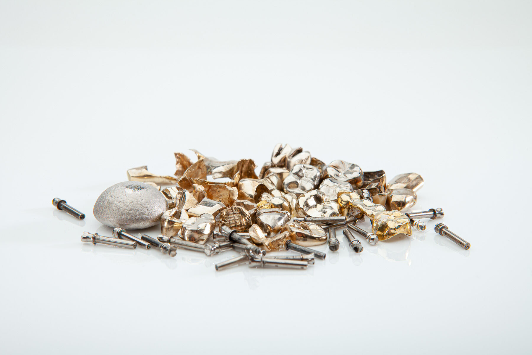 gold-zahn-goldig-zaehne Zahngold  mit Schmelzbarren